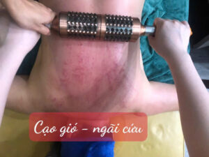 massage hoà khánh đà nẵng