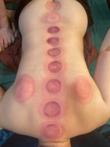 trị liệu cổ vai gáy đà nẵng