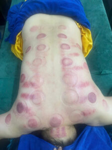 trị liệu cổ vai gáy đà nẵng